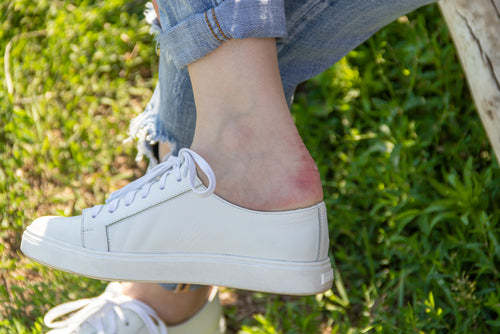 Can You Stop Blisters with Antiperspirant? The Science of Dry Feet