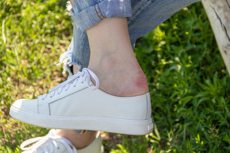 Can You Stop Blisters with Antiperspirant? The Science of Dry Feet